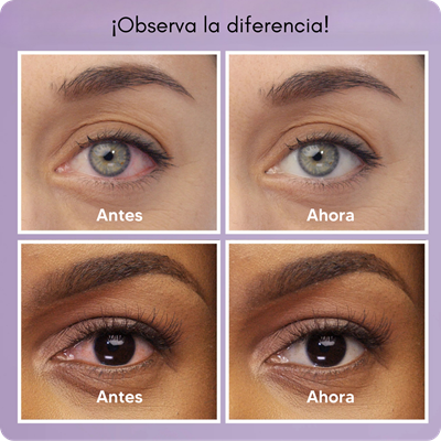 2x1 Gotas Milagrosas Lumify